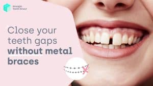 4 out of 5 dentists recommend