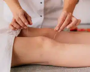 How do I get more acupuncture clients? How do I get more acupuncture clients?