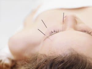 Showcasing techniques on acupuncture website